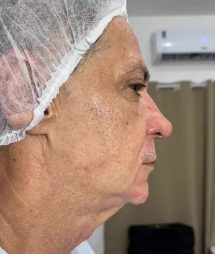 Antes do Microfocado: cliente de perfil.