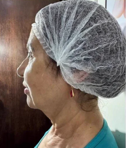 Antes do Microfocado: cliente de perfil.