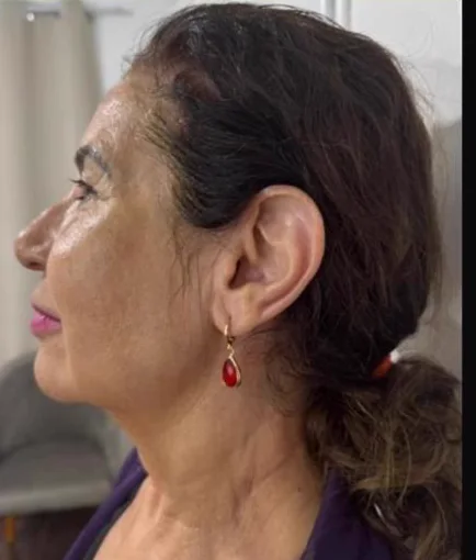 Depois do Microfocado: cliente de perfil.