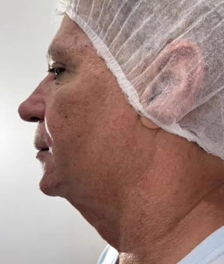 Antes do Microfocado: cliente de perfil.