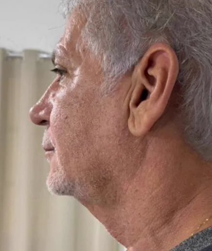 Depois do Microfocado: cliente de perfil.