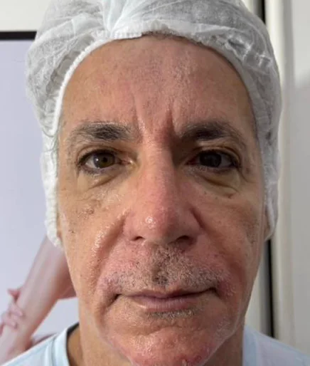 Antes do Microfocado: cliente de frente.