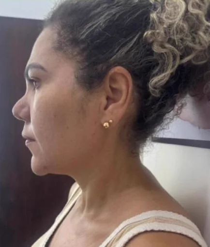 Antes do Microfocado: cliente de perfil.