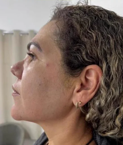 Depois do Microfocado: cliente de perfil.