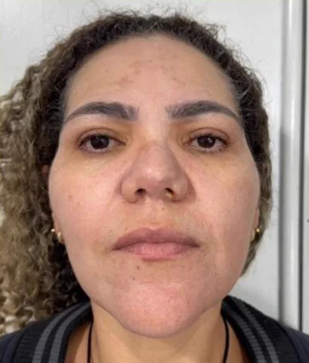 Depois do Microfocado: cliente de frente.