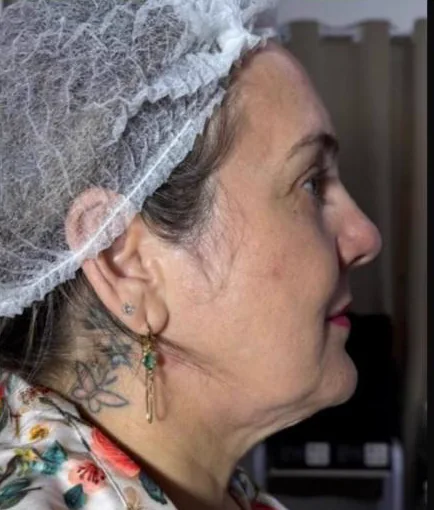 Antes do Microfocado: cliente de perfil.