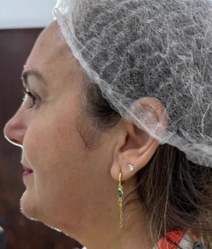 Antes do Microfocado: cliente de perfil.