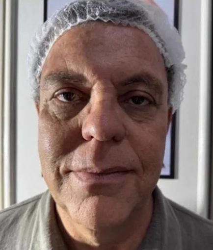 Antes do Microfocado: cliente de frente.