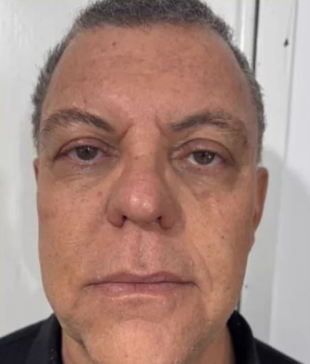 Depois do Microfocado: cliente de frente.
