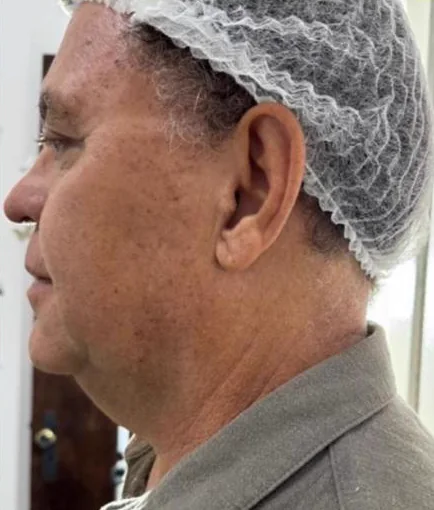 Antes do Microfocado: cliente de perfil.