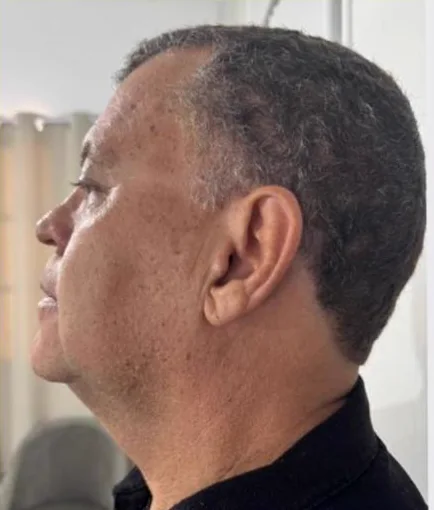 Depois do Microfocado: cliente de perfil.